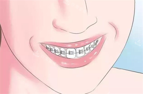金属矫正动画展示图 金属矫正动画展示图