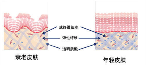 衰老皮肤与年轻皮肤对比图