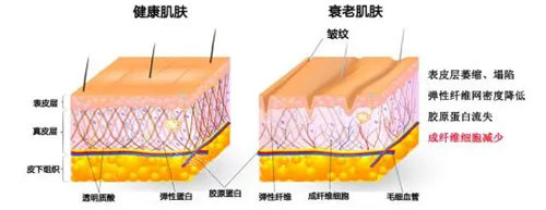 健康皮膚與衰老肌膚展示圖 健康皮膚與衰老肌膚展示圖