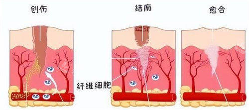 创伤型肌肤动画展示图