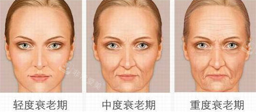 衰老過程動畫圖 衰老過程動畫圖