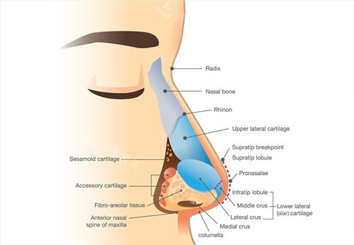 假体隆鼻手术图