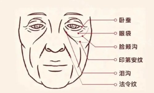 面部脂肪填充抗衰 面部脂肪填充抗衰