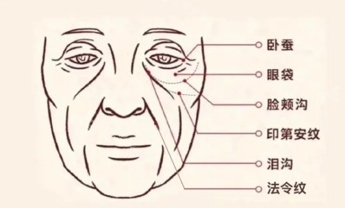 面部脂肪填充抗衰