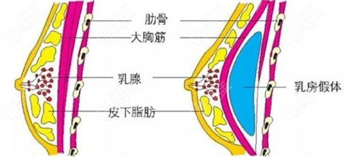 胸部结构示意图 胸部结构示意图