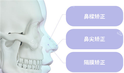 韩国绮林整形鼻子整形细节部位展示