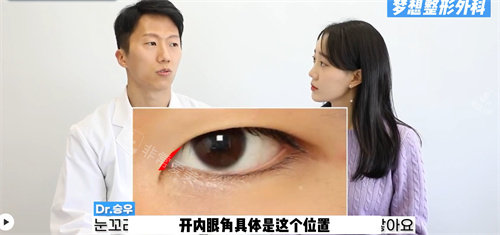 開內(nèi)眼角的位置