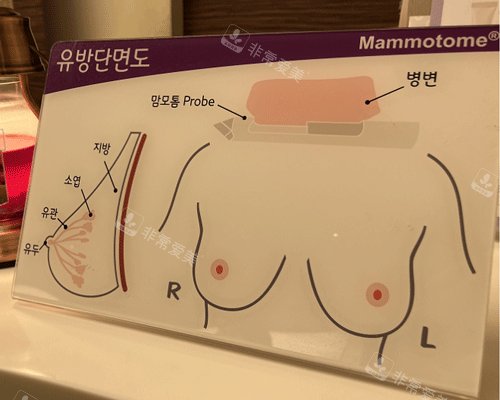 胸部的美觀指標(biāo)