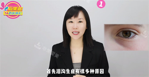 淚溝形成的原因 淚溝形成的原因