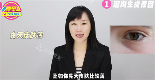 皮膚薄的人容易有淚溝 皮膚薄的人容易有淚溝