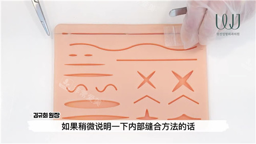 金奎希院長演示縫合手術(shù) 金奎希院長演示縫合手術(shù)