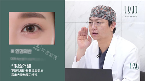 韩国WJ原辰整形外科刘永善院长讲解图 韩国WJ原辰整形外科刘永善院长讲解图