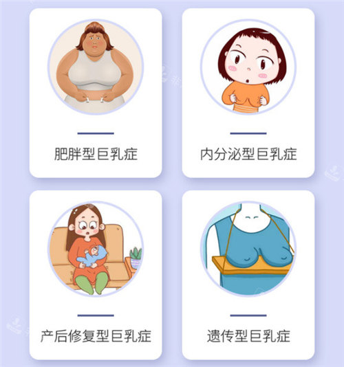 乳房過大的幾種原因類型