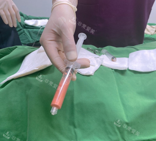 韓國JF皮膚科富貴包治療抽取出來的組織 韓國JF皮膚科富貴包治療抽取出來的組織