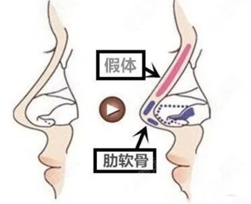 韩国来客like整形精致自然鼻型很受欢迎，国内顾客多！