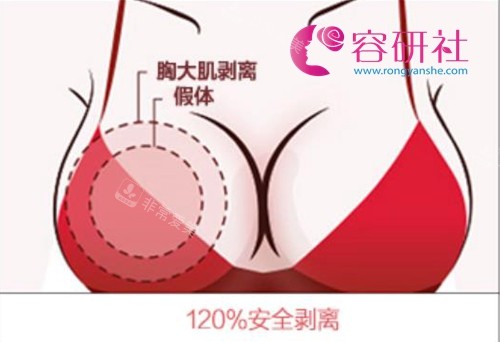 韓國(guó)普羅菲耳整形醫(yī)院假體隆胸優(yōu)勢(shì) 韓國(guó)普羅菲耳整形醫(yī)院假體隆胸優(yōu)勢(shì)