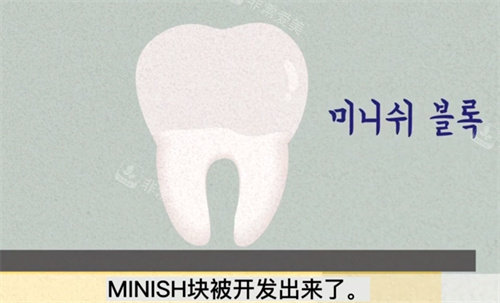 MINISH塊的研發(fā) MINISH塊的研發(fā)