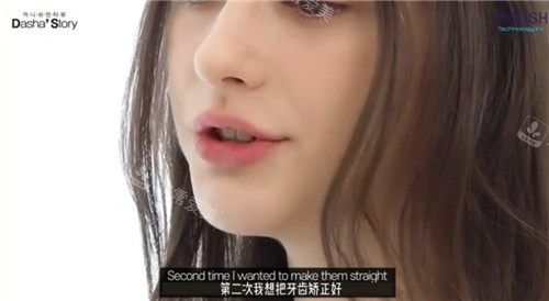 Dasha Taran做矯正視頻 Dasha Taran做矯正視頻