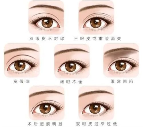 各种眼睛问题修复 各种眼睛问题修复