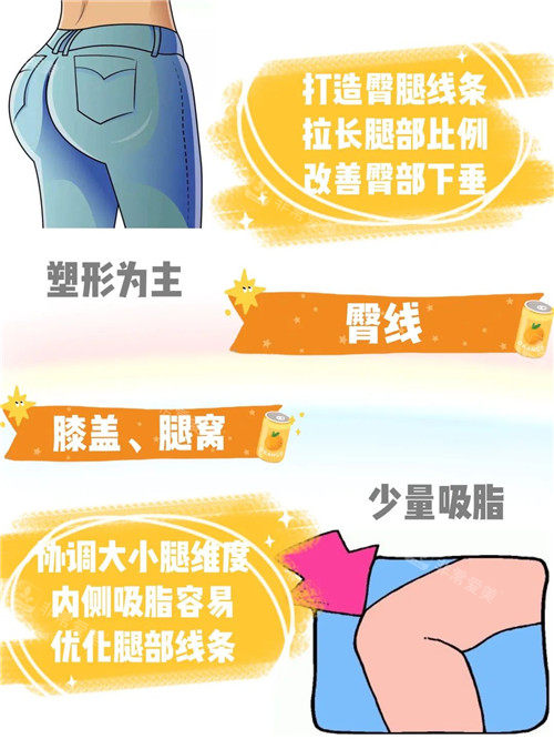 吸脂臀線的處理細(xì)節(jié)圖