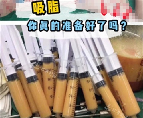 吸脂術(shù)后可能會(huì)出現(xiàn)哪些問題 吸脂術(shù)后可能會(huì)出現(xiàn)哪些問題