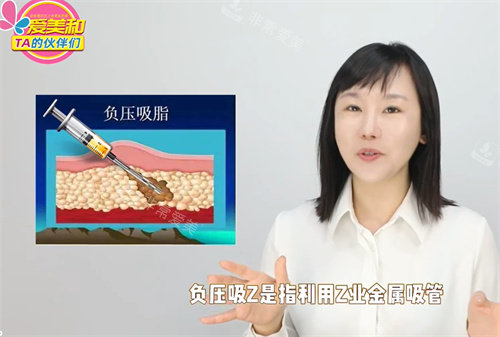 負(fù)壓吸脂 負(fù)壓吸脂