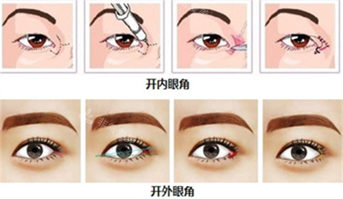 開眼角圖 開眼角圖