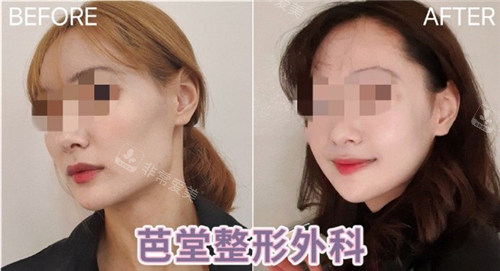 黄镕硕轮廓三件套前后对比照 黄镕硕轮廓三件套前后对比照