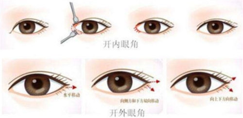 開內(nèi)眼角與外眼角圖