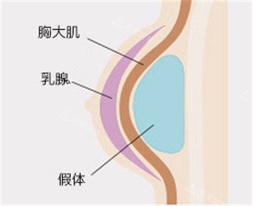 韩国MIND整形隆胸技术好吗 李永泽院长临床经验很丰富！