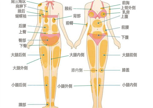 身體吸脂部位展示圖