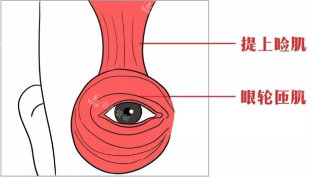 眼部提肌和上睑下垂有区别吗？眼部提肌可以改善上睑下垂