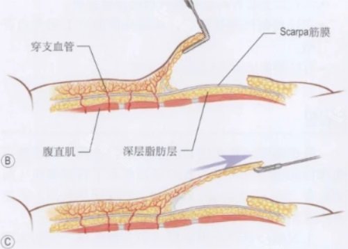 腹部皮肤结构示意图