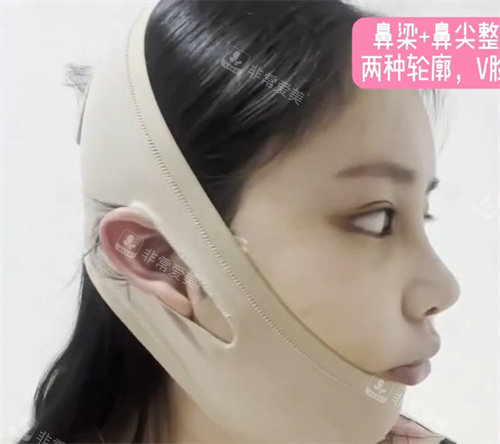 术后7天 术后7天