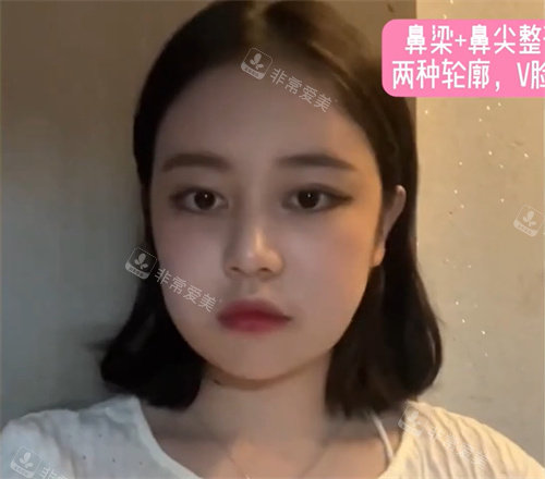术后三个月 术后三个月