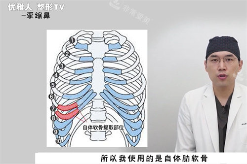 挛缩鼻修复使用自体软骨