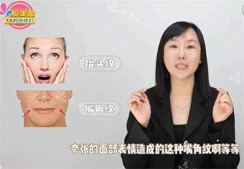 动态皱纹抬头纹和嘴角纹