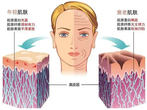 皱纹图片