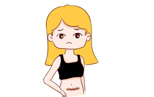 剖腹產(chǎn)疤痕動畫圖 剖腹產(chǎn)疤痕動畫圖
