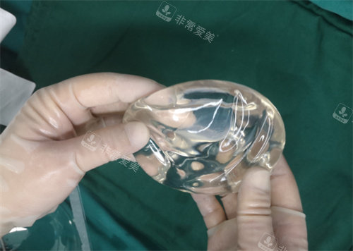 圓形光面假體參考圖 圓形光面假體參考圖