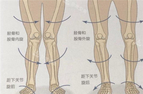 腿部畸形的細(xì)節(jié)表現(xiàn)圖片