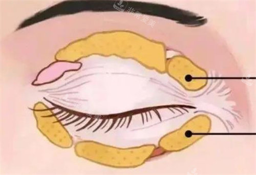 眼部脂肪分布動(dòng)畫圖 眼部脂肪分布動(dòng)畫圖