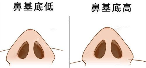 鼻基底图