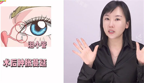 雙眼皮后流淚的原因 雙眼皮后流淚的原因