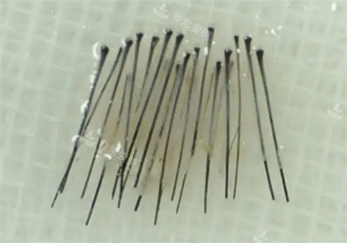 毛囊照片 毛囊照片