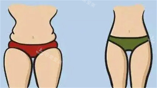 腰腹环吸动画对比图 腰腹环吸动画对比图