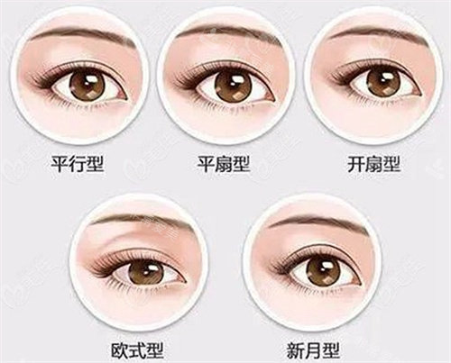 雙眼皮類型