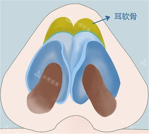 耳软骨展示图