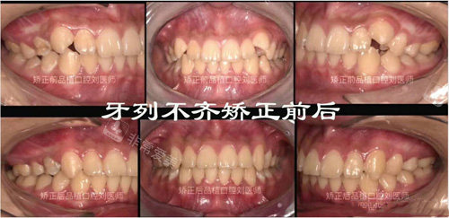 柳州品植口腔牙齒矯正