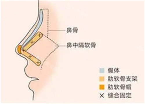 鼻部组织介绍图片